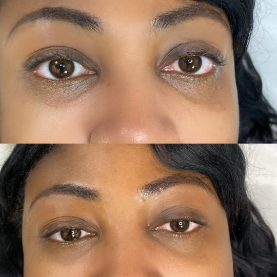 Before and After Under Eye Camouflage
